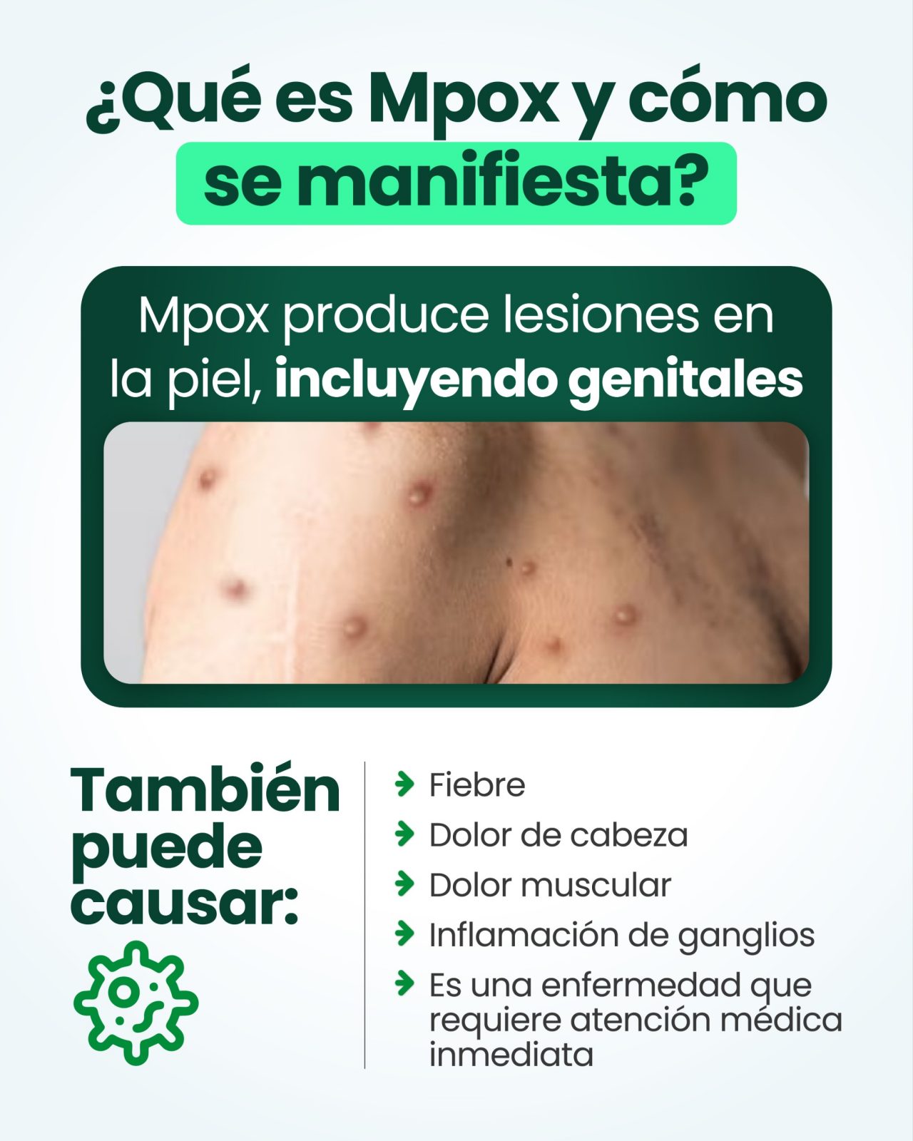 ¿Qué es Mpox y cómo se manifiesta? Mpox produce lesiones en la piel, incluyendo genitales. También puede causar: fiebre, dolor de cabeza, dolor muscular, inflamación de ganglios, es una enfermedad que requiere atención médica inmediata,