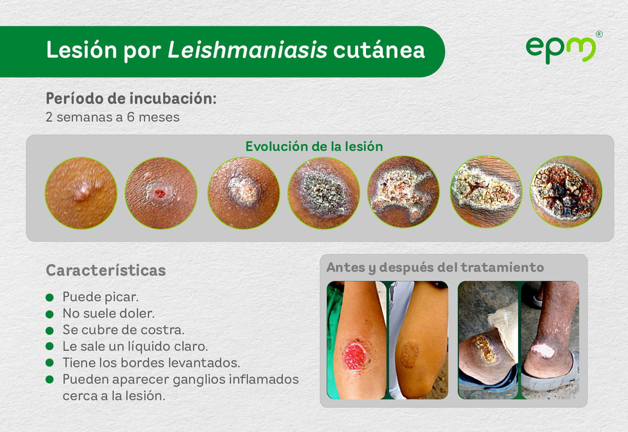 Evolución de la lesión